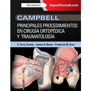 Campbell. Principales Procedimientos En Cirugía Ortopédica Y Traumatología 1ª edición