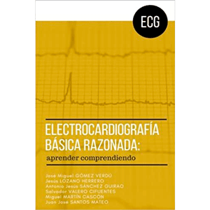 Electrocardiografía básica razonada: aprender comprendiendo 1ª edición